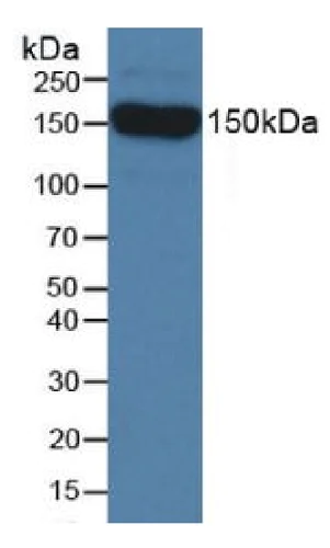 Western blot - Anti-SEMA5B antibody (AB231202)