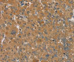 Immunohistochemistry (Formalin/PFA-fixed paraffin-embedded sections) - Anti-SEMA6D antibody - N-terminal (AB198745)