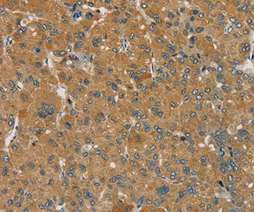 Immunohistochemistry (Formalin/PFA-fixed paraffin-embedded sections) - Anti-SEMA6D antibody - N-terminal (AB198745)