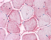 Immunohistochemistry (Formalin/PFA-fixed paraffin-embedded sections) - Anti-SEMAC antibody (AB118458), expandable thumbnail