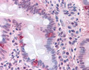 Immunohistochemistry (Formalin/PFA-fixed paraffin-embedded sections) - Anti-SEMAC antibody (AB118458), expandable thumbnail