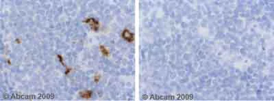 Immunohistochemistry (Formalin/PFA-fixed paraffin-embedded sections) - Anti-Semaphorin 3A antibody (AB23393)