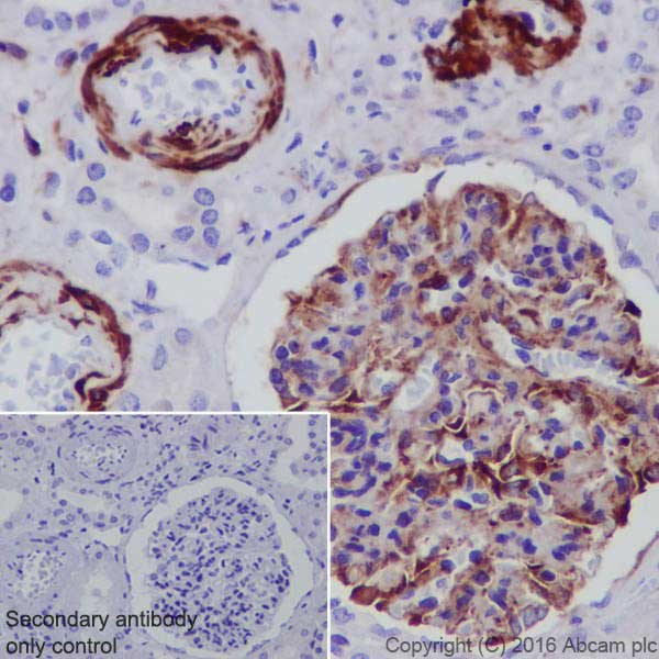 Immunohistochemistry (Formalin/PFA-fixed paraffin-embedded sections) - Anti-Semaphorin 3A antibody [EPR19367] (AB199475), expandable thumbnail