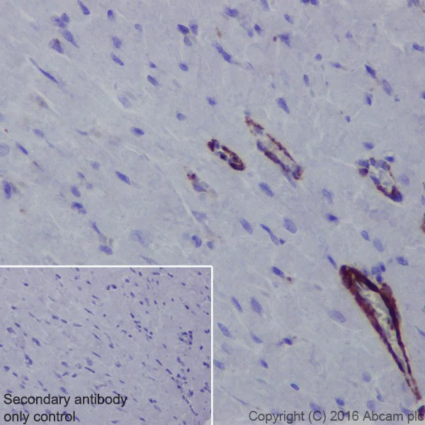 Immunohistochemistry (Formalin/PFA-fixed paraffin-embedded sections) - Anti-Semaphorin 3A antibody [EPR19367] (AB199475)