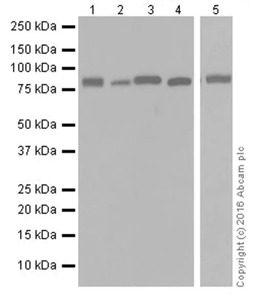 Western blot - Anti-Semaphorin 3A antibody [EPR19367] (AB199475)