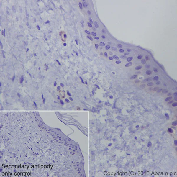 Immunohistochemistry (Formalin/PFA-fixed paraffin-embedded sections) - Anti-Semaphorin 3A antibody [EPR19367] - Low endotoxin, Azide free (AB222497)