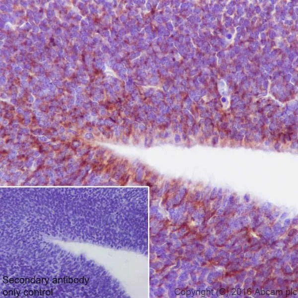 Immunohistochemistry (Formalin/PFA-fixed paraffin-embedded sections) - Anti-Semaphorin 3A antibody [EPR19367] - Low endotoxin, Azide free (AB222497)