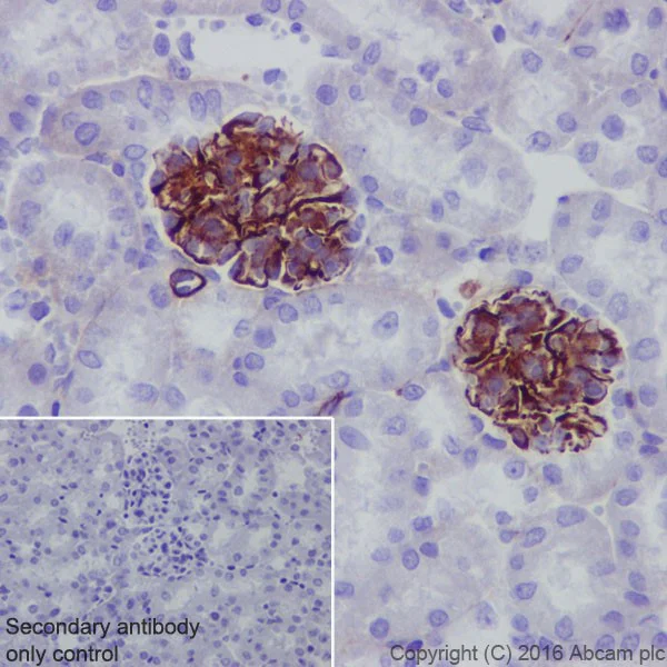 Immunohistochemistry (Formalin/PFA-fixed paraffin-embedded sections) - Anti-Semaphorin 3A antibody [EPR19367] - Low endotoxin, Azide free (AB222497)