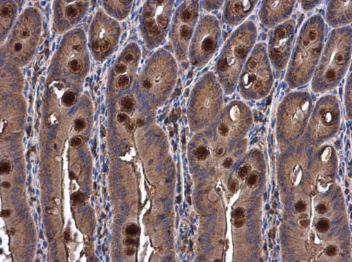 Immunohistochemistry (Formalin/PFA-fixed paraffin-embedded sections) - Anti-Semaphorin 3A antibody - N-terminal (AB226793)