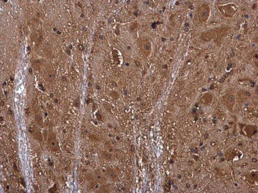 Immunohistochemistry (Formalin/PFA-fixed paraffin-embedded sections) - Anti-Semaphorin 3A antibody - N-terminal (AB226793)