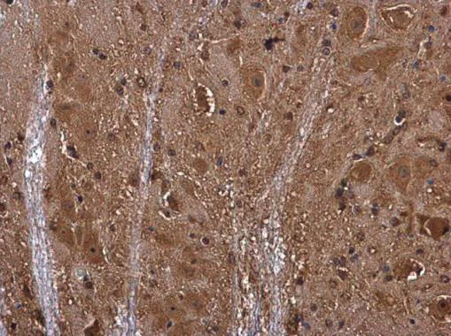 Immunohistochemistry (Formalin/PFA-fixed paraffin-embedded sections) - Anti-Semaphorin 3A antibody - N-terminal (AB226793)