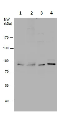 Western blot - Anti-Semaphorin 3A antibody - N-terminal (AB226793)