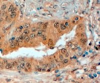Immunohistochemistry (Formalin/PFA-fixed paraffin-embedded sections) - Anti-Semaphorin 3E antibody (AB112886), expandable thumbnail