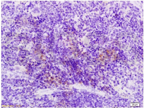 Immunohistochemistry (Formalin/PFA-fixed paraffin-embedded sections) - Anti-Semaphorin 3F antibody (AB203394)
