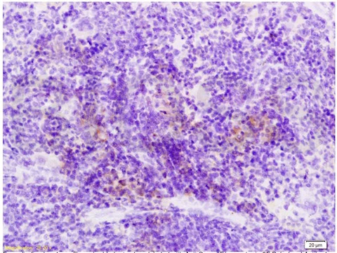 Immunohistochemistry (Formalin/PFA-fixed paraffin-embedded sections) - Anti-Semaphorin 3F antibody (AB203394)