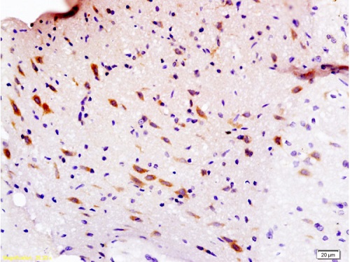 Immunohistochemistry (Formalin/PFA-fixed paraffin-embedded sections) - Anti-Semaphorin 3F antibody (AB203394)