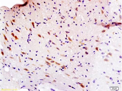 Immunohistochemistry (Formalin/PFA-fixed paraffin-embedded sections) - Anti-Semaphorin 3F antibody (AB203394)