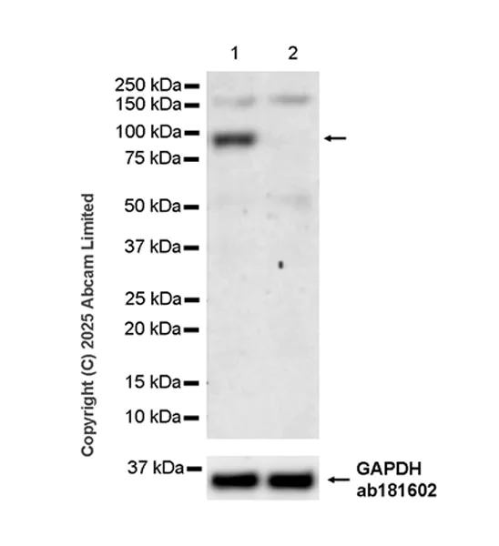 Western blot - Anti-Semaphorin 3F antibody [EPR29155-75] (AB323565)