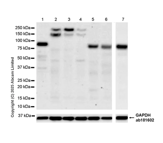 Western blot - Anti-Semaphorin 3F antibody [EPR29155-75] (AB323565)