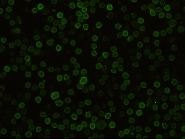 Immunocytochemistry - Anti-Semaphorin 4D/CD100 antibody [010] - BSA and Azide free (AB277139)