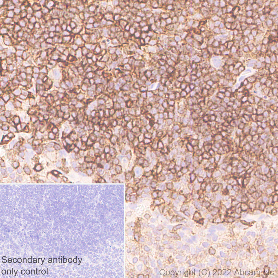 Immunohistochemistry (Formalin/PFA-fixed paraffin-embedded sections) - Anti-Semaphorin 4D/CD100 antibody [30/CD100] (AB307685), expandable thumbnail