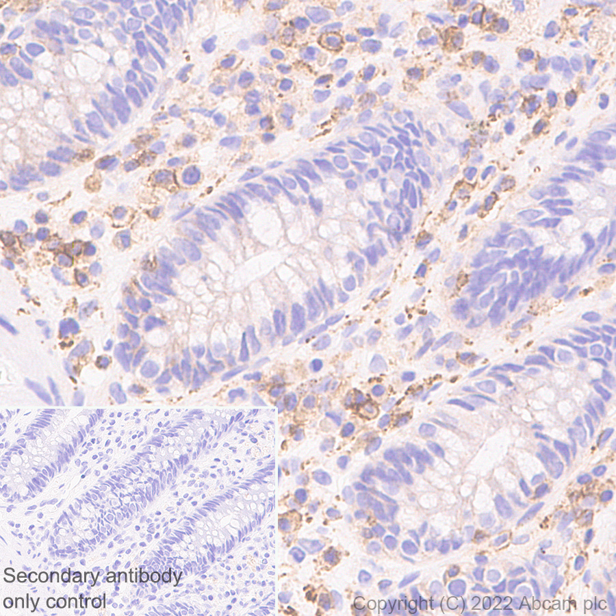 Immunohistochemistry (Formalin/PFA-fixed paraffin-embedded sections) - Anti-Semaphorin 4D/CD100 antibody [30/CD100] (AB307685), expandable thumbnail