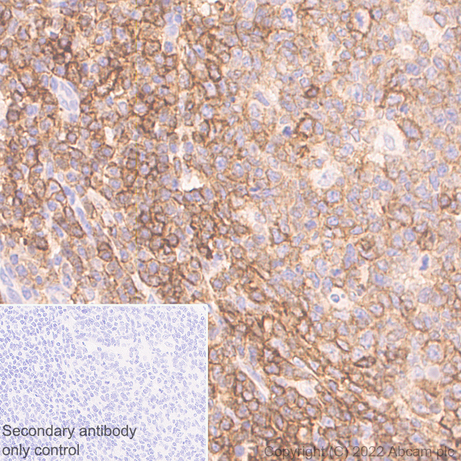 Immunohistochemistry (Formalin/PFA-fixed paraffin-embedded sections) - Anti-Semaphorin 4D/CD100 antibody [30/CD100] (AB307685), expandable thumbnail