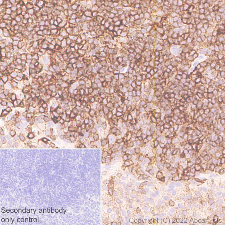 Immunohistochemistry (Formalin/PFA-fixed paraffin-embedded sections) - Anti-Semaphorin 4D/CD100 antibody [30/CD100] - BSA and Azide free (AB307686)