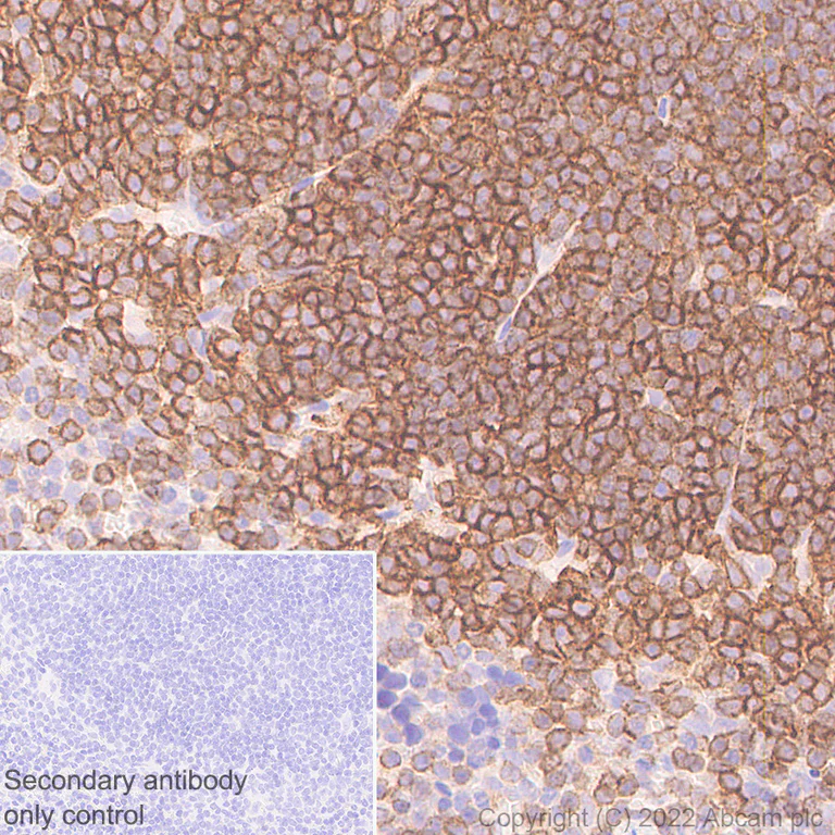 Immunohistochemistry (Formalin/PFA-fixed paraffin-embedded sections) - Anti-Semaphorin 4D/CD100 antibody [30/CD100] - BSA and Azide free (AB307686)
