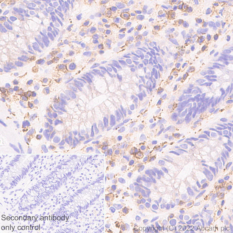 Immunohistochemistry (Formalin/PFA-fixed paraffin-embedded sections) - Anti-Semaphorin 4D/CD100 antibody [30/CD100] - BSA and Azide free (AB307686)