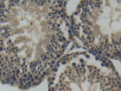 Immunohistochemistry (Formalin/PFA-fixed paraffin-embedded sections) - Anti-Semaphorin 4D/CD100 antibody (AB231961)