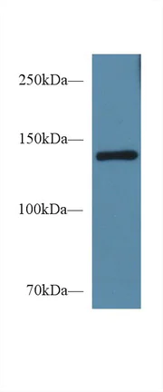 Western blot - Anti-Semaphorin 4D/CD100 antibody (AB231961)