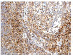 Immunohistochemistry (Formalin/PFA-fixed paraffin-embedded sections) - Anti-Semaphorin 4D/CD100 antibody [EP3569] (AB134128)
