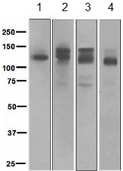 Western blot - Anti-Semaphorin 4D/CD100 antibody [EP3569] (AB134128)