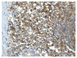 Immunohistochemistry (Formalin/PFA-fixed paraffin-embedded sections) - Anti-Semaphorin 4D/CD100 antibody [EP3569] - BSA and Azide free (AB248692)