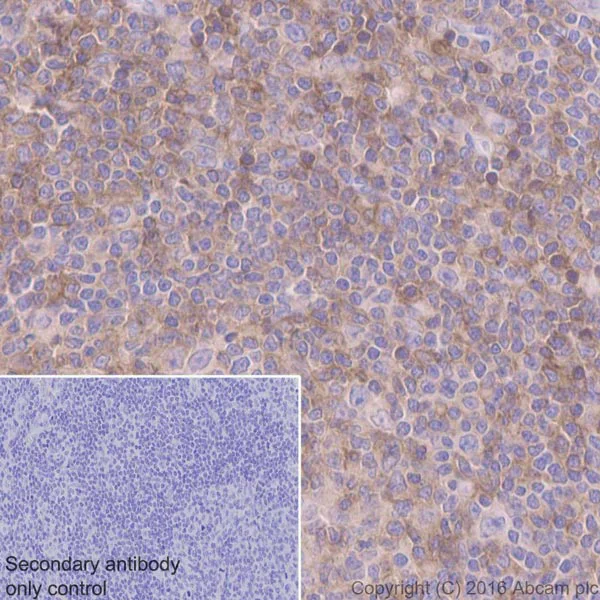 Immunohistochemistry (Formalin/PFA-fixed paraffin-embedded sections) - Anti-Semaphorin 4D/CD100 antibody [EP3569] - BSA and Azide free (AB248692)