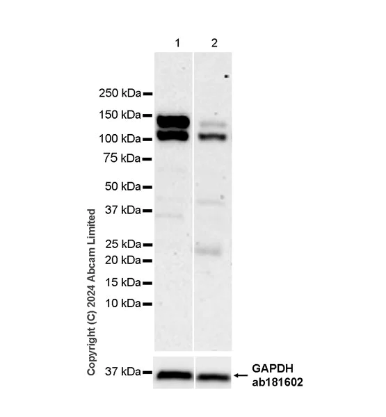 Western blot - Anti-Semaphorin 4D/CD100 antibody [EPR26247-28] (AB320634)
