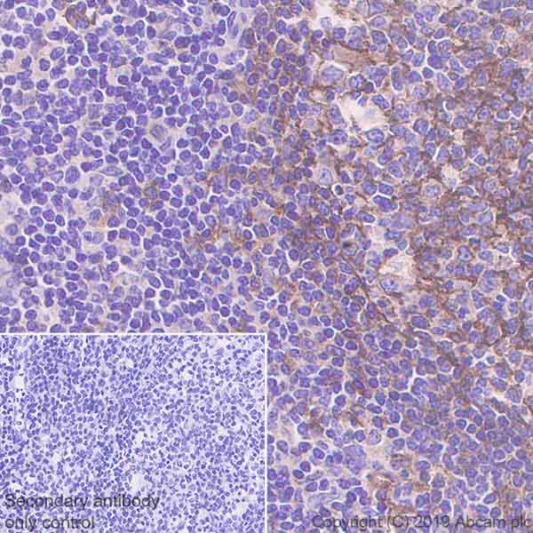 Immunohistochemistry (Formalin/PFA-fixed paraffin-embedded sections) - Anti-Semaphorin 7a antibody [EPR22644-79] (ab255602), expandable thumbnail
