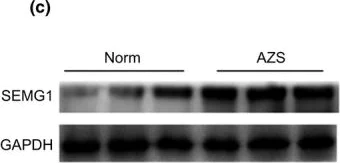 Western blot - Anti-Semenogelin I antibody [EPR3675(2)] (AB139405)