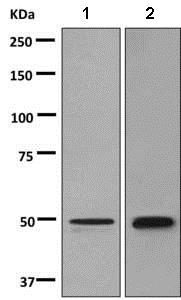Western blot - Anti-Semenogelin I antibody [EPR3675(2)] (AB139405)