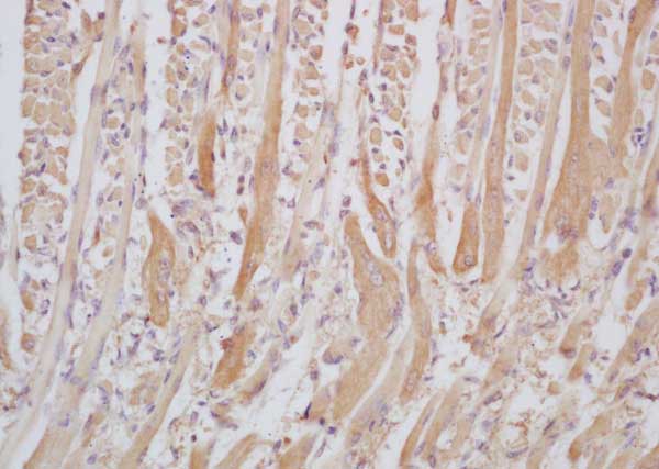Immunohistochemistry (Formalin/PFA-fixed paraffin-embedded sections) - Anti-Senataxin antibody (AB214183)