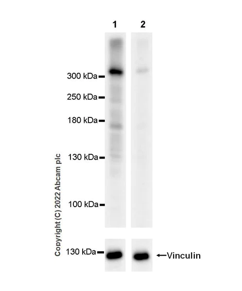 Western blot - Anti-Senataxin antibody [EPR24137-74] - BSA and Azide free (AB300440)