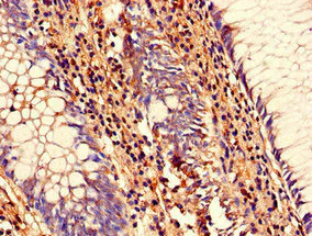 Immunohistochemistry (Formalin/PFA-fixed paraffin-embedded sections) - Anti-SENP1 antibody (AB236094)