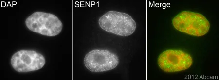 Immunocytochemistry/ Immunofluorescence - Anti-SENP1 antibody [EPR3844] - BSA and Azide free (AB239937)