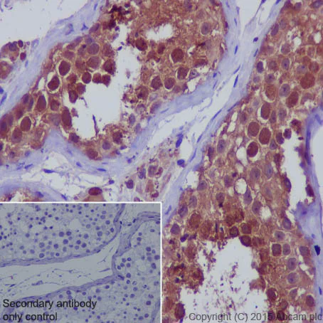 Immunohistochemistry (Formalin/PFA-fixed paraffin-embedded sections) - Anti-SENP1 antibody [EPR3844] - BSA and Azide free (AB239937)