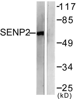 Western blot - Anti-SENP2 antibody (AB58418)