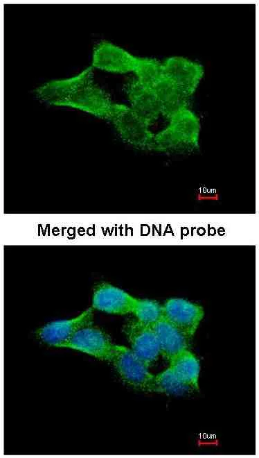 Immunocytochemistry/ Immunofluorescence - Anti-SENP2 antibody (AB96865)