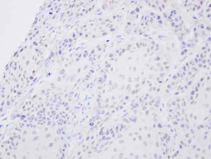Immunohistochemistry (Formalin/PFA-fixed paraffin-embedded sections) - Anti-SENP2 antibody (AB96865)