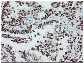Immunohistochemistry (Formalin/PFA-fixed paraffin-embedded sections) - Anti-SENP2 antibody [OTI1H2] (AB131637)