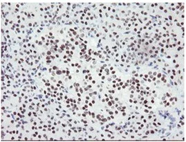 Immunohistochemistry (Formalin/PFA-fixed paraffin-embedded sections) - Anti-SENP2 antibody [OTI1H2] (AB131637)